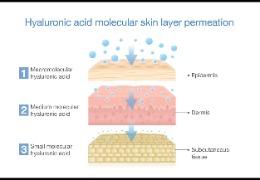 如何選擇適合油痘肌的精華產(chǎn)品？